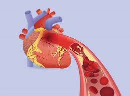 تغییرات فیزیولوژیک قلب ، عروق و گردش خون در حاملگی 19 اسلاید