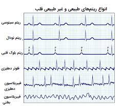 پاورپوینت مراحل خواندن و تفسیر ECG