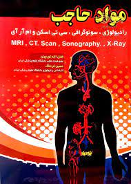 پاورپوینت مواد حاجب